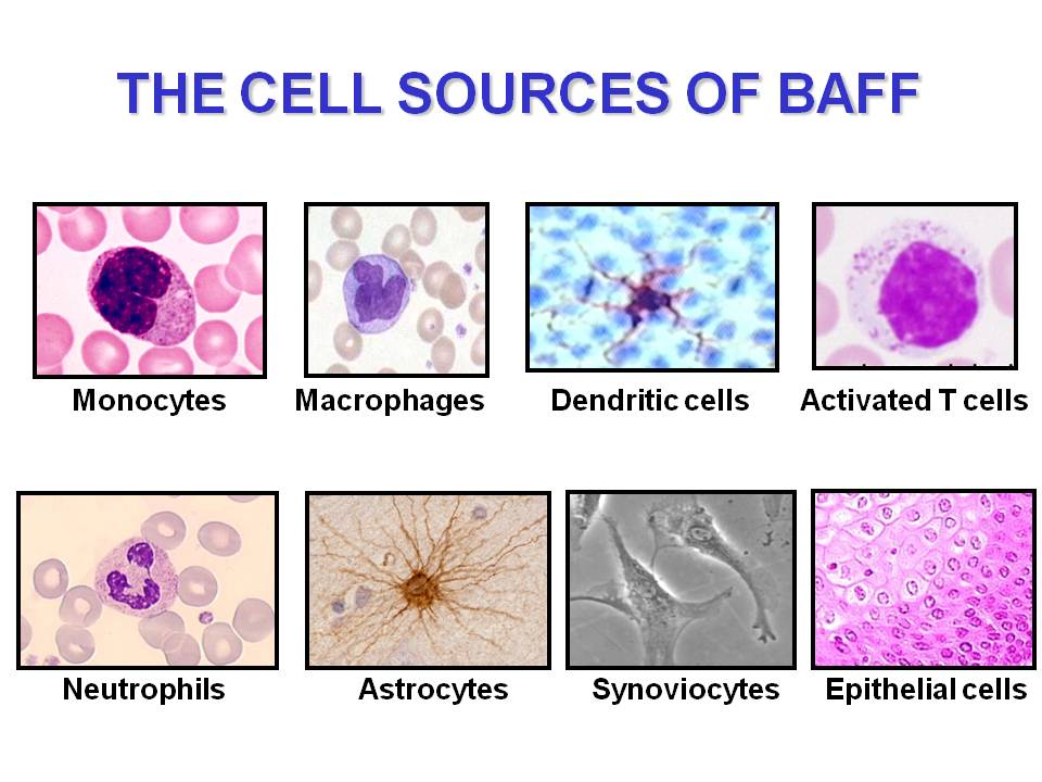 Baff In Sjogren's Syndrome: A Rewarding Approach To B Cells - Bodossaki ...