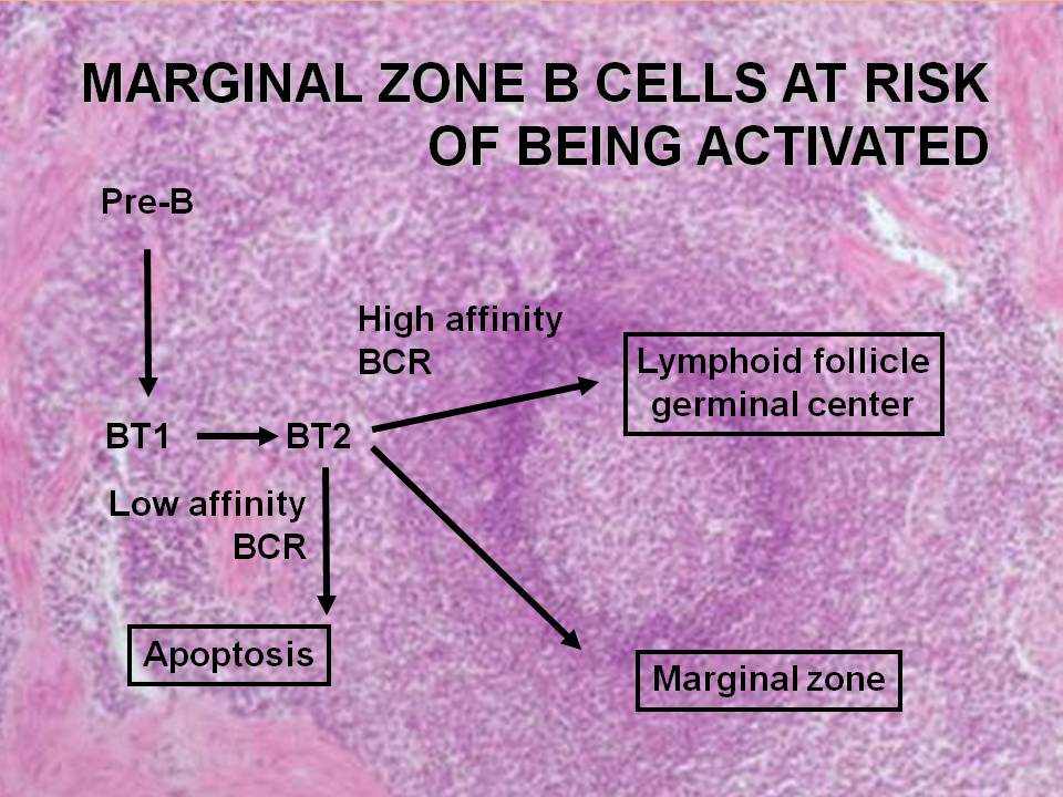 Baff In Sjogren's Syndrome: A Rewarding Approach To B Cells - Bodossaki ...